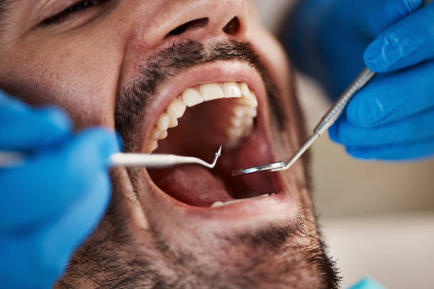 Best Dentist for Tooth Abscess  in Vinton, IA